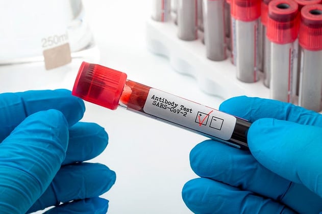 Blood sample labelled Antibody test - SARS-CoV-2
