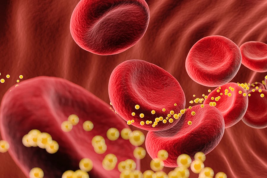 Going Beyond Cholesterol – Introducing the Advanced Cardiovascular Risk ...